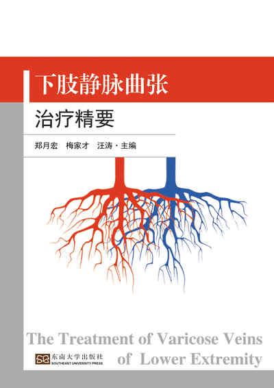 下肢靜脈曲張治療精要 出版公司:東南大學出版社 作者:鄭月宏、梅家才、汪濤 類型:醫藥養生-醫療專業 PDF電子書 繁體中文版