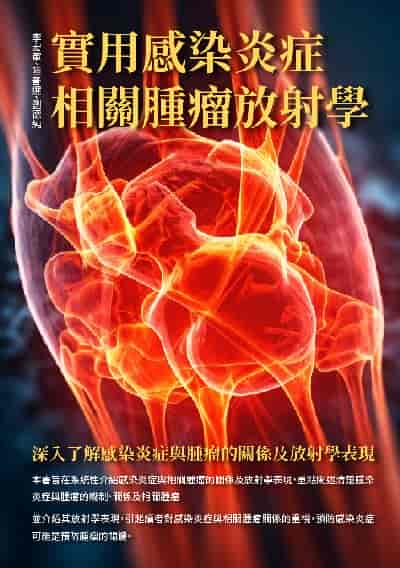 實用感染炎症相關腫瘤放射學:深入了解感染炎症與腫瘤的關係及放射學表現 出版公司:崧博出版 作者:李宏軍、陸普選、劉德純 類型:醫藥養生-醫藥常識 EPUB電子書 繁體中文版